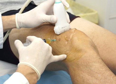 Infiltrazioni articolari